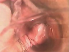 Insertion - Speculum Camera Inside Vagina!