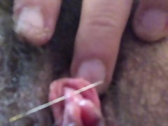 Needle on the clitoris